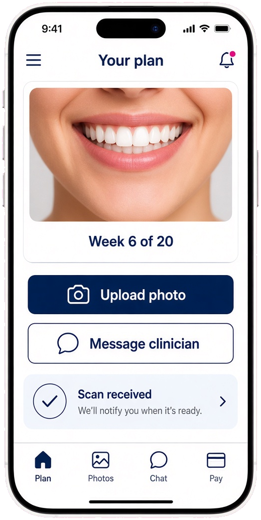 Byte clone remote orthodontic app